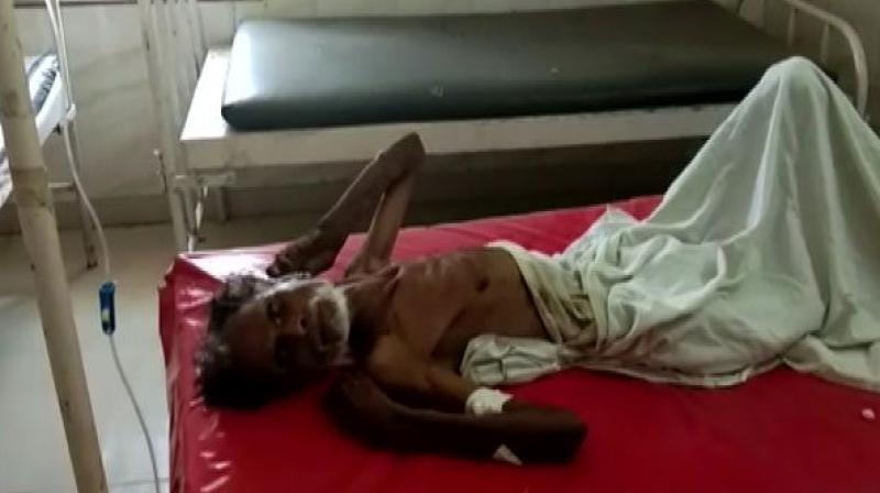 72-year-old man declared dead by MP govt hospital, found alive next day