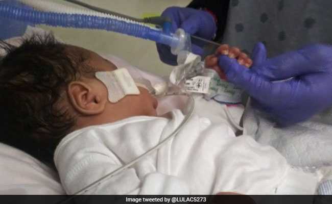 Baby Cut Out Of 19-Year-Old Mother's Womb In US Dies