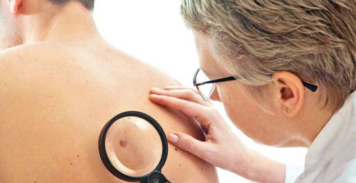 Experts say skin diseases may develop due to COVID-19