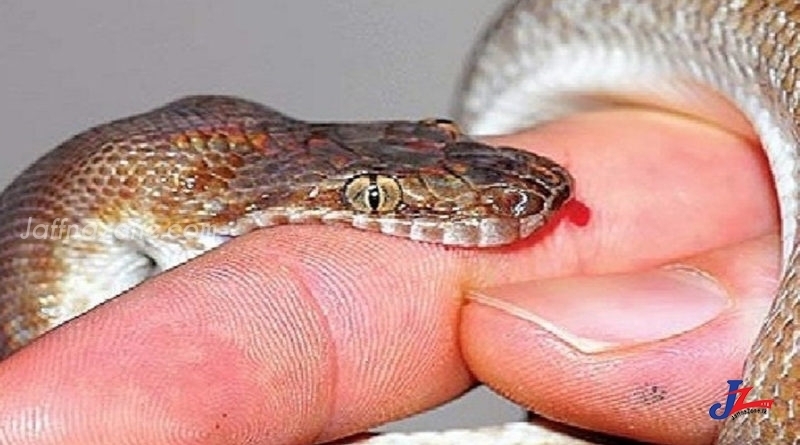 A 15 year old boy bitten by a cobra snake went to hospital with the snake bit him!