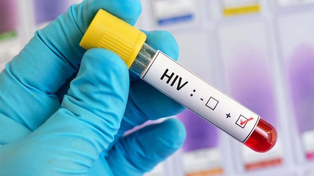 50 undergrads found positive for HIV!